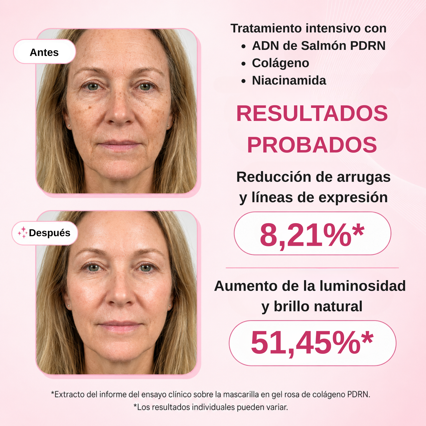 Tratamiento PDRN de Salmón