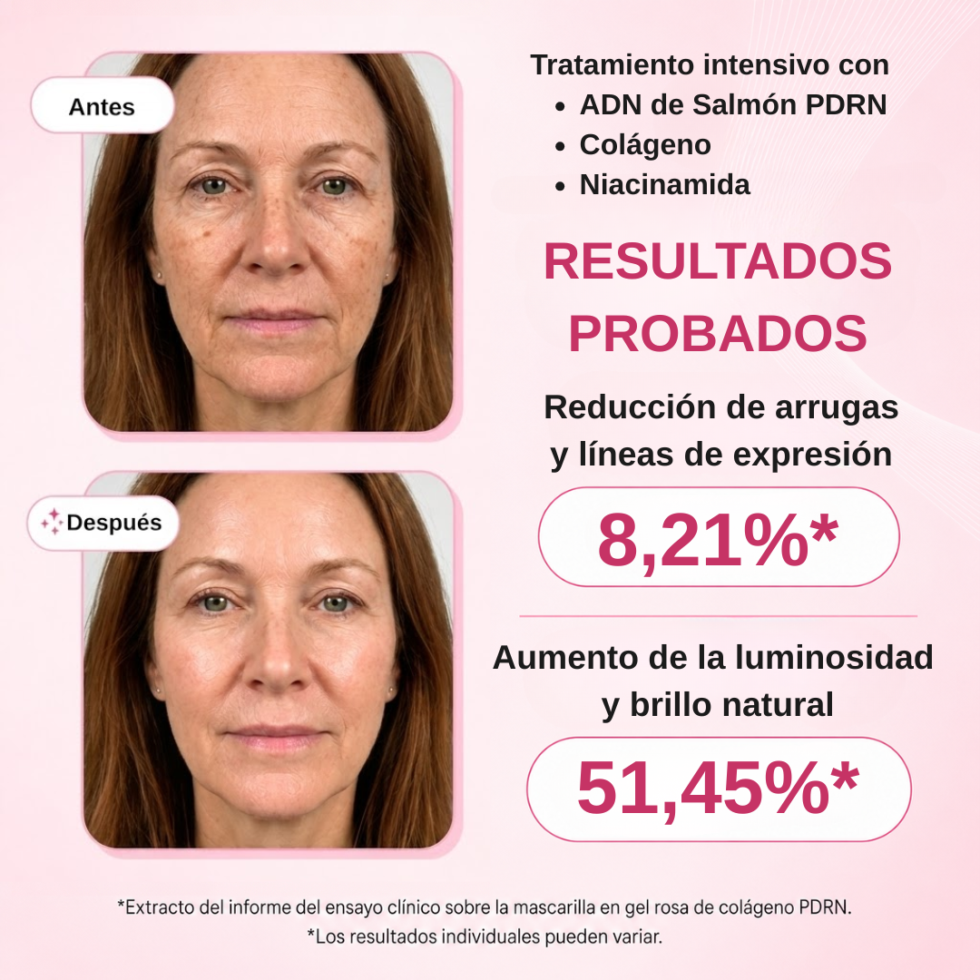 Tratamiento PDRN de Salmón y Colágeno