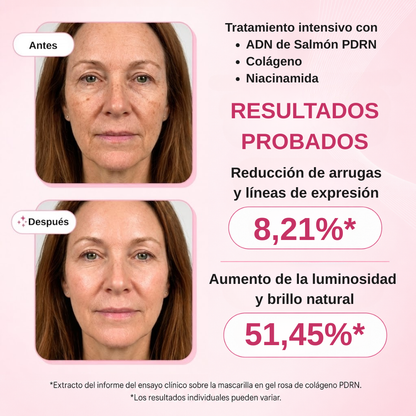 Tratamiento PDRN de Salmón y Colágeno